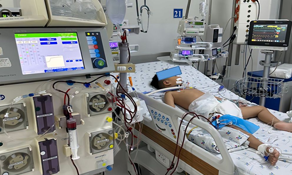 Tây Ninh: Bé trai 5 tuổi suy gan nặng, lọc máu liên tục vì 1 kiểu uống thuốc hạ sốt