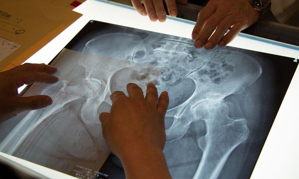 Cụ bà 70 tuổi có xương trẻ khỏe như phụ nữ 30, bác sĩ kinh ngạc khi biết bí quyết