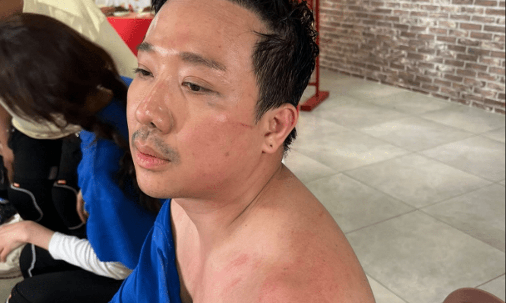 Trấn Thành tiếp tục phải trả giá