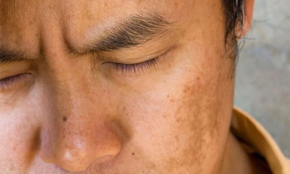 Cơ thể xuất hiện 4 biểu hiện bất thường này vào buổi sáng cảnh báo gan đang mang “mầm bệnh”: Có 3/4 thì phải đi khám ngay 