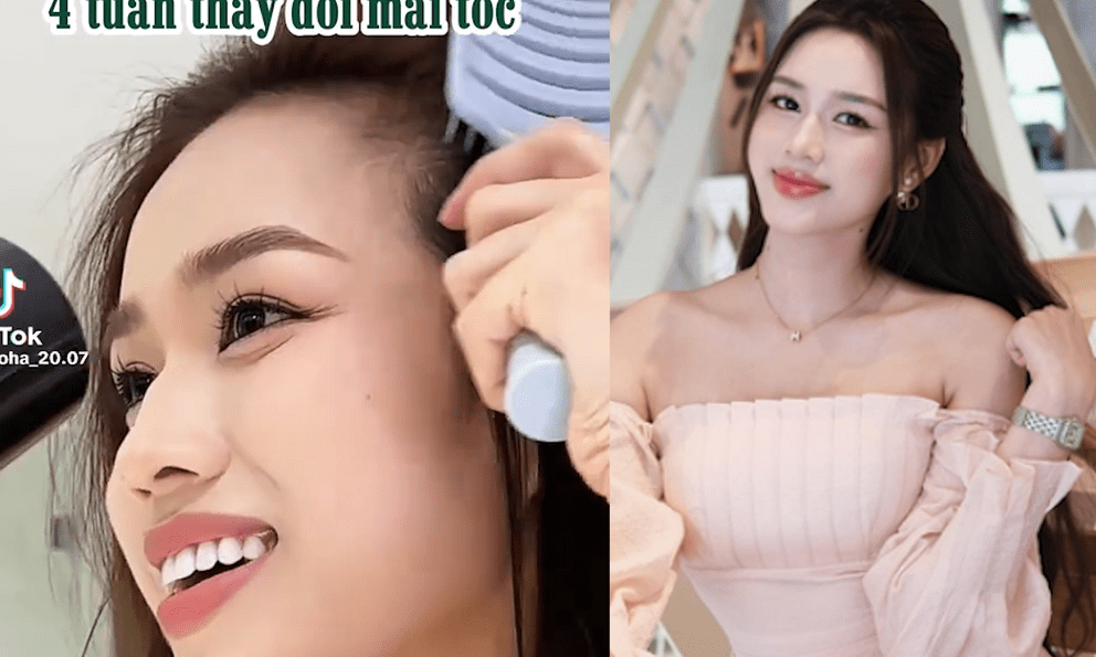 Hoa hậu Đỗ Hà để lộ khuyết điểm nhan sắc ở tuổi 23