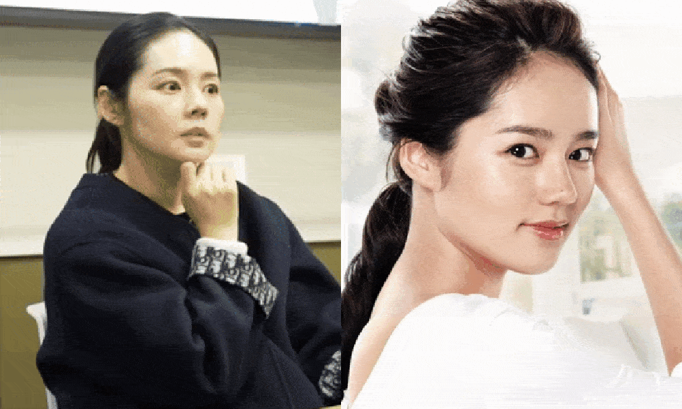 “Tường thành nhan sắc” Han Ga In bị thẩm mỹ viện hét giá 610 triệu để dao kéo khắp mặt