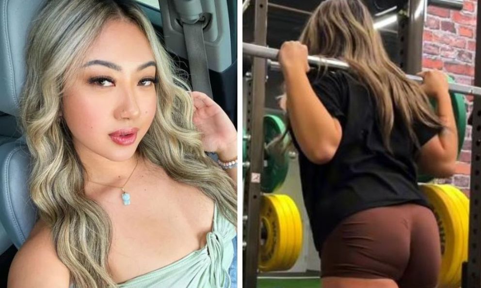 Cô gái ngày nào cũng đi tập gym bỗng phát hiện tóc bị rụng cả mảng, ngỡ ngàng khi đến gặp bác sĩ