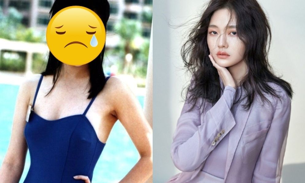 1 Hoa hậu hàng đầu bị cúm và viêm phổi giống Từ Hy Viên, rơi vào tình trạng nguy hiểm chỉ sau 2 ngày phát bệnh