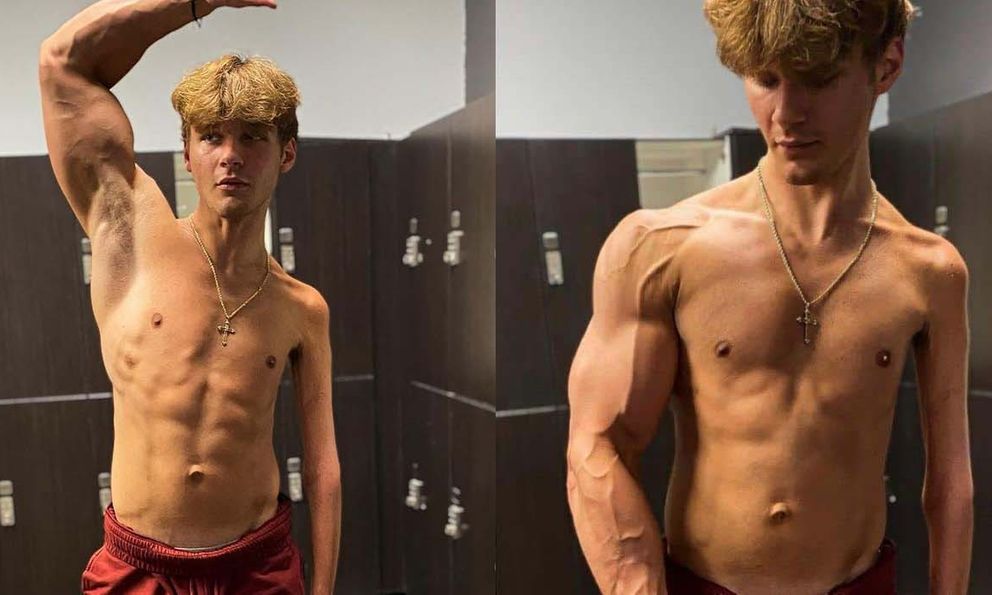 Nam thanh niên ngày nào cũng tập gym nhưng một tay khổng lồ một tay tí hon, xúc động trước lý do đằng sau