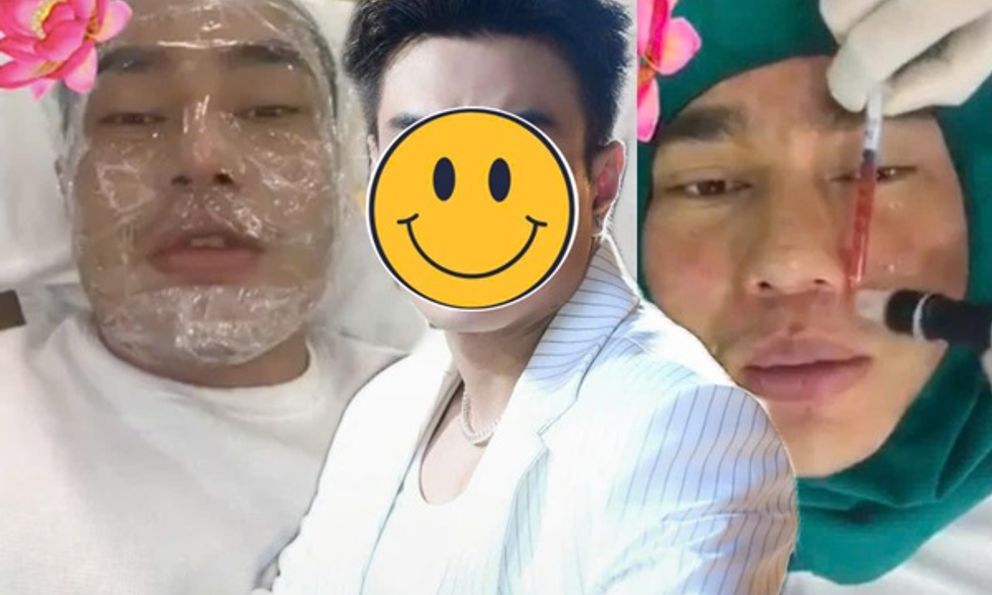 Sao nam Việt nghiện phẫu thuật thẩm mỹ: Từng cứ 10 ngày lại đi chỉnh sửa 1 lần, bị tụt sụn mũi khi đang chạy bộ